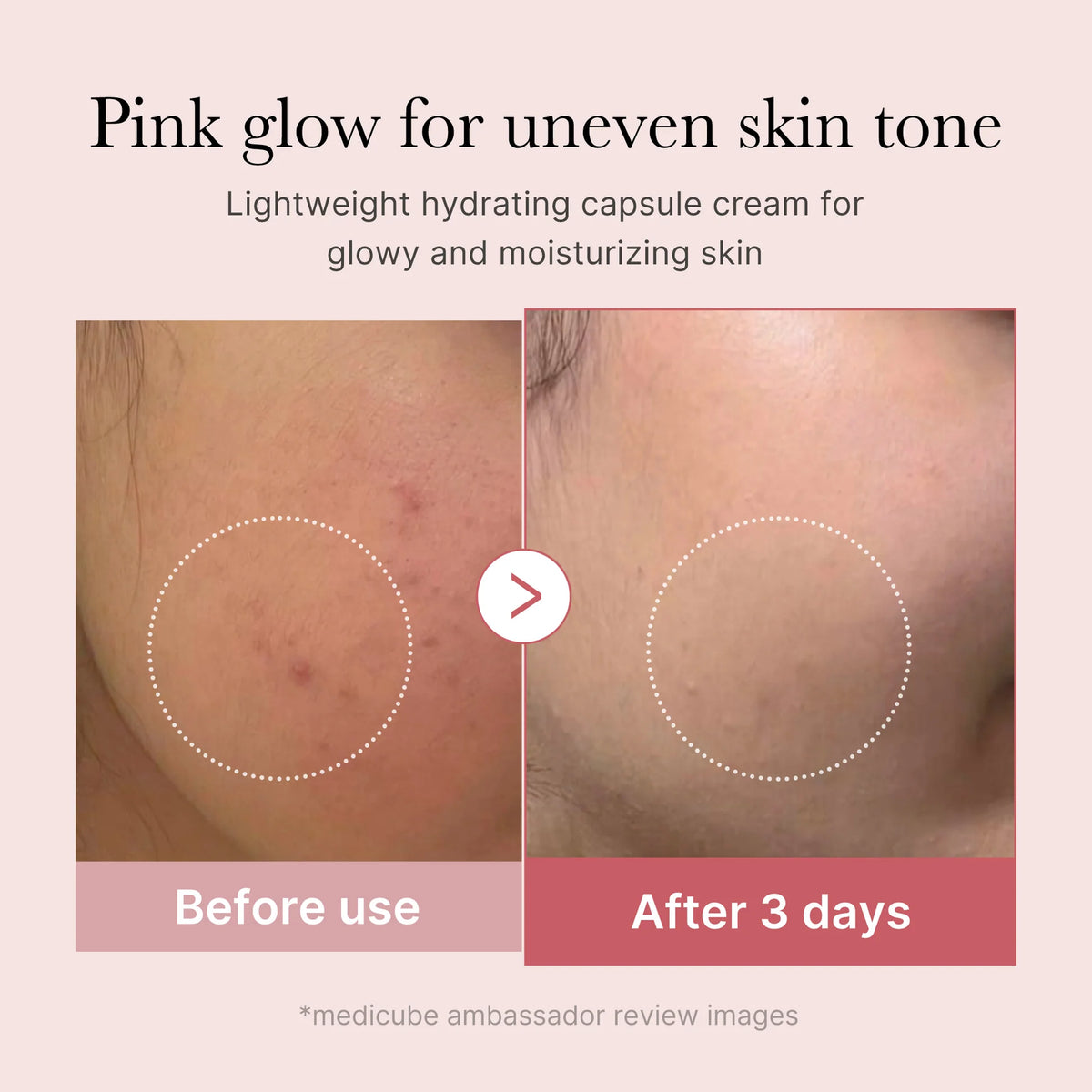 Roze capsulecrème met before/after huidvergelijking rond het product