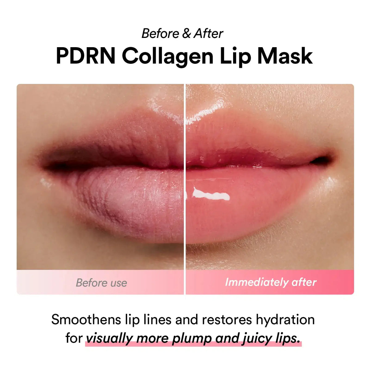 Abib PDRN Collagen Lip Mask Glazed Jelly Lipmasker voor en na: gehydrateerde, glanzende lippen