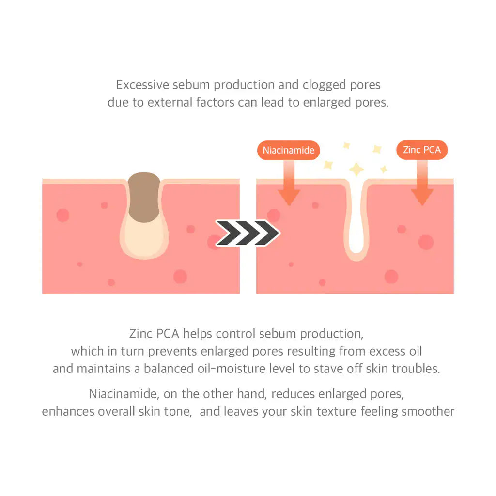 Niacinamide-serum infographic met doorsnede van huidcellen en pijlen naar poriën.