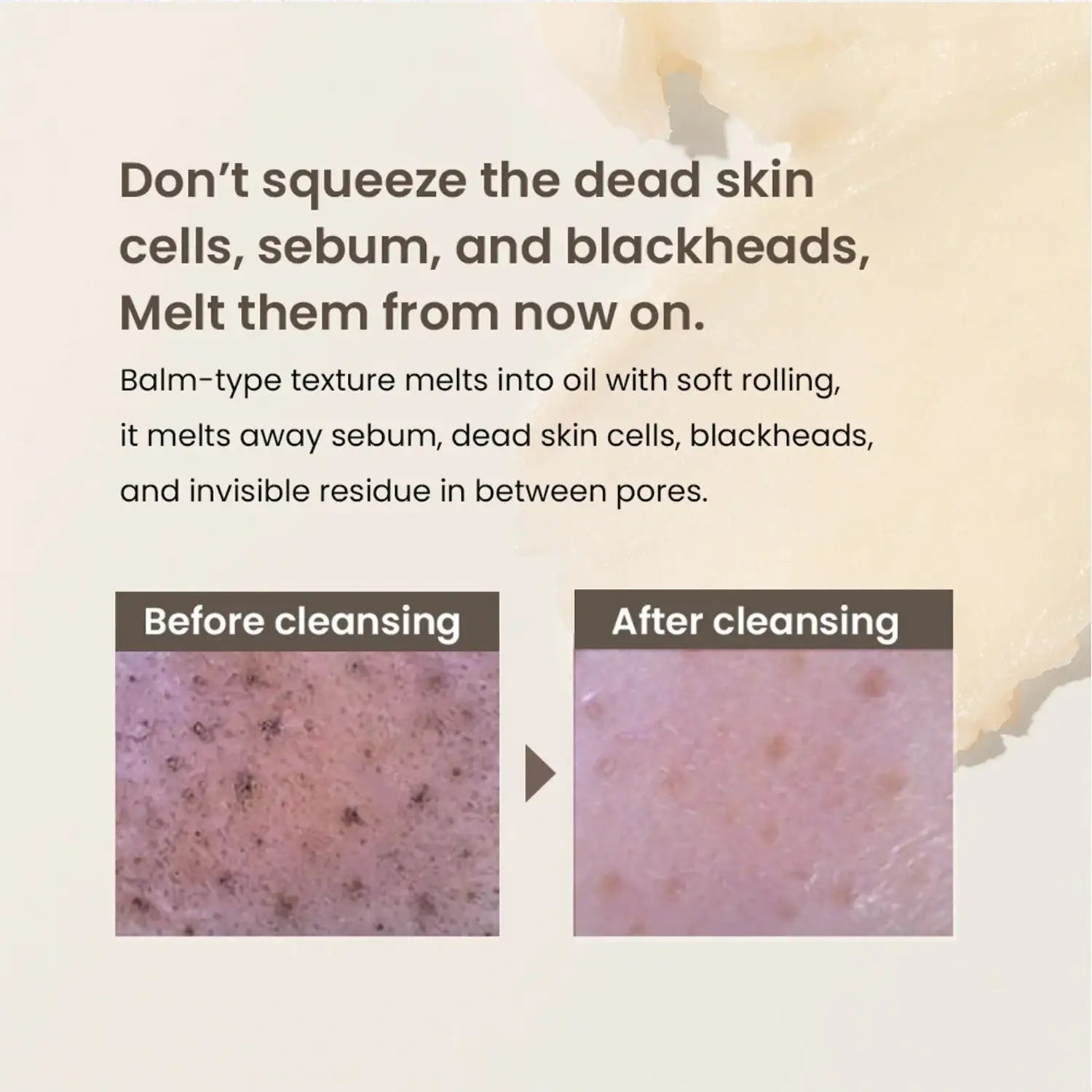 Mandarin reinigingsbalsem infographic met huidbeelden voor en na het reinigen