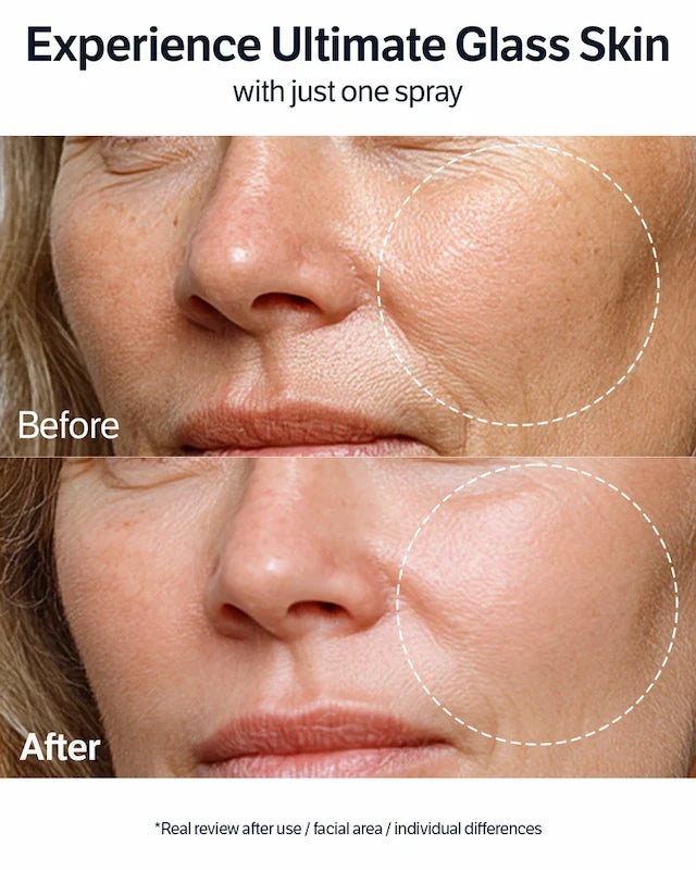 Voor en na foto Sungboon Editor Deep Collagen Barrier Serum Mist – zichtbaar gladdere en vochtrijkere huid na gebruik, Experience Ultimate Glass Skin with just one spray