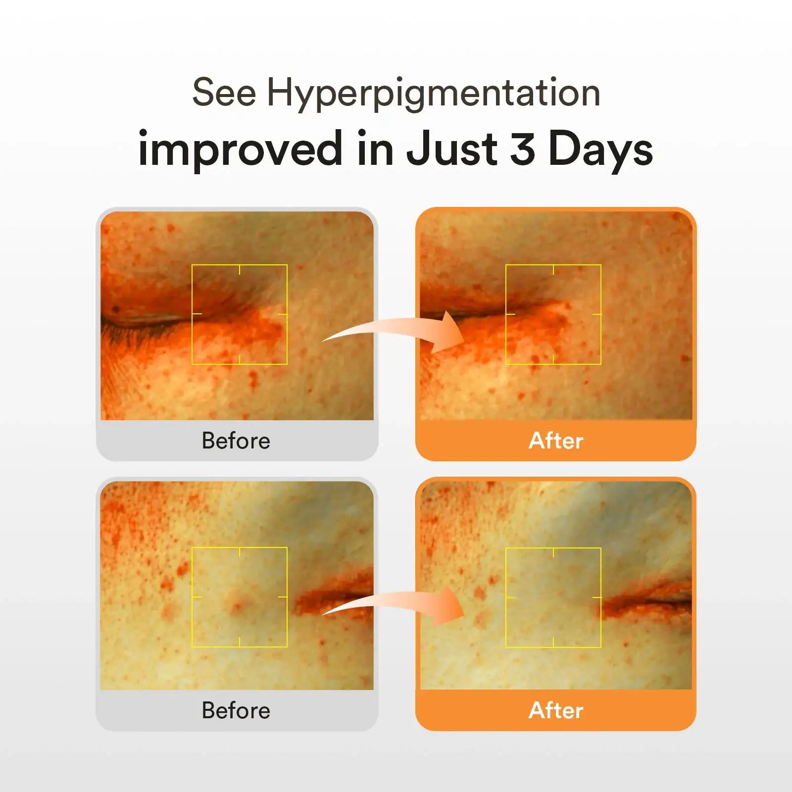 Abib Glutathiosome dark spot serum Vita drop Huidclose-up met oranje vlekjes en gemarkeerde zones