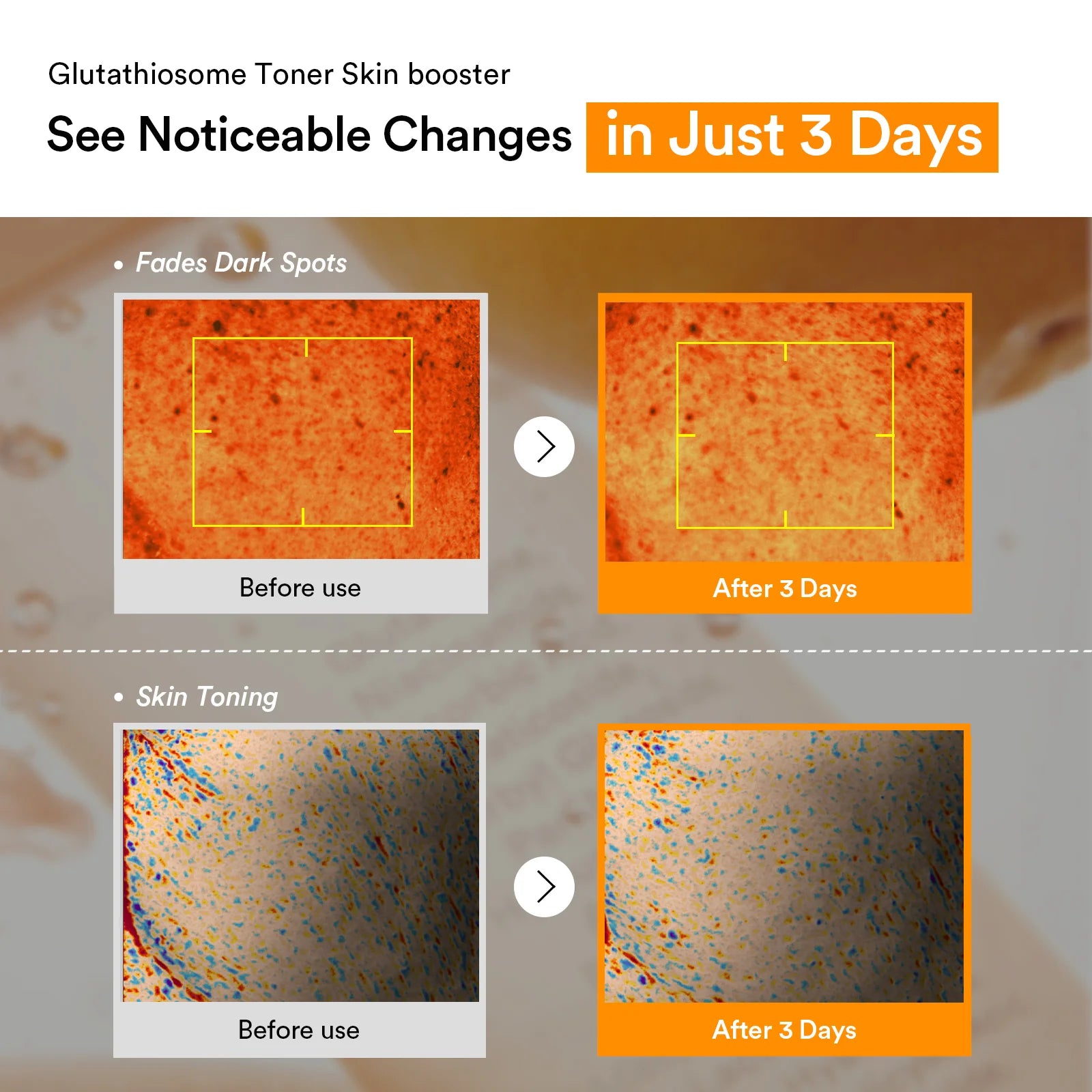 Glutathiosome dark spot toner Skin booster RESULTS IN 3 DAYS