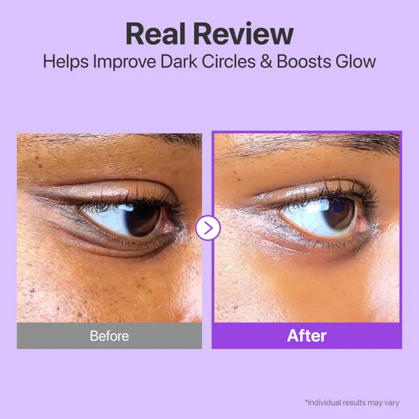 No.9 NAD Retinol Volumetox Eye Cream