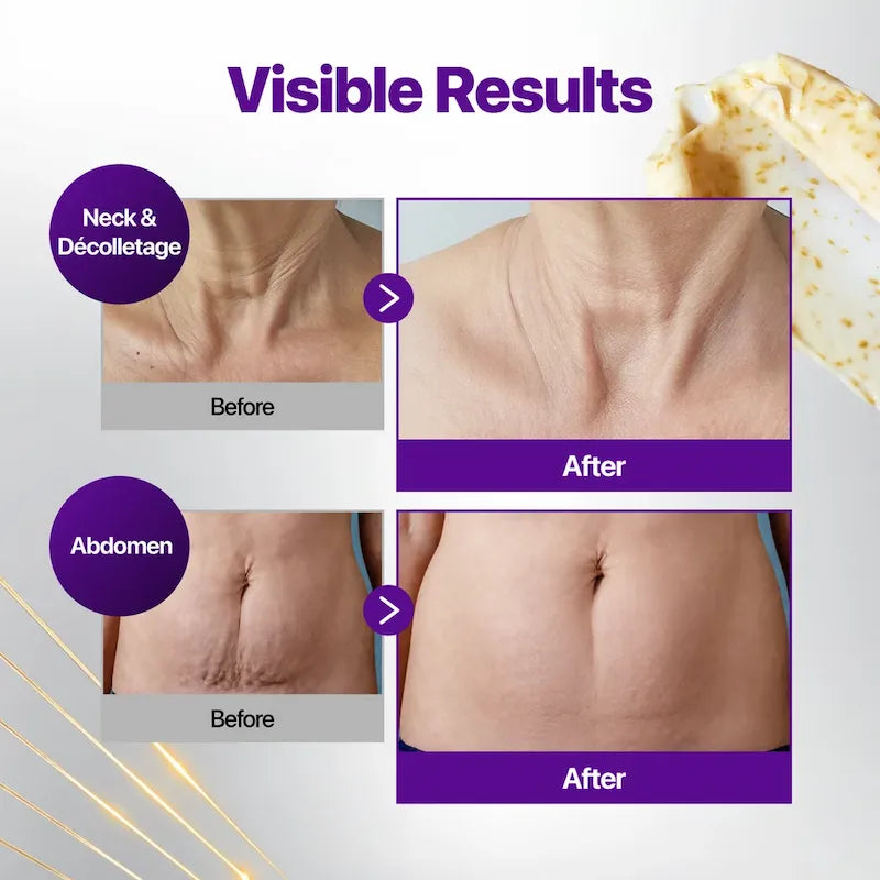 Voor-en-nafoto’s van hals, decolleté en buik bij Numbuzin No.9 NAD+ Gold 3D Firming Cream.