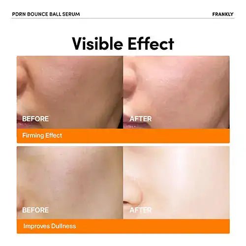 FRANKLY PDRN Bounce Ball Serum Voor-na huidpanelen op gezicht met oranje effect op de huid