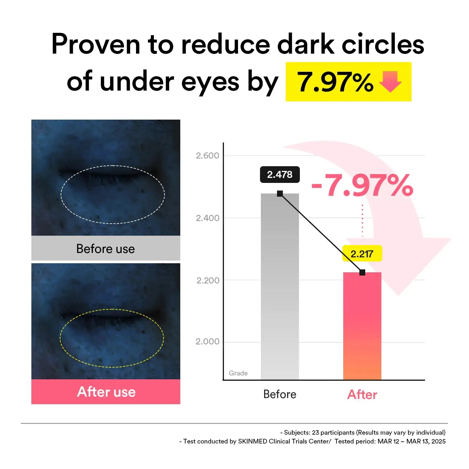 Abib PDRN Retinal Eye Patch Glow Jelly Staafdiagram met voor-na resultaat voor minder donkere kringen onder de ogen