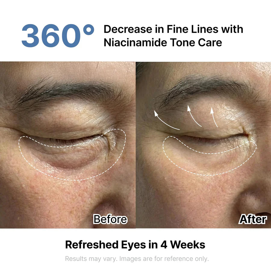 Zijde-peptide EGF intensieve oogcrème zichtbaar effect op het oog, voor en na