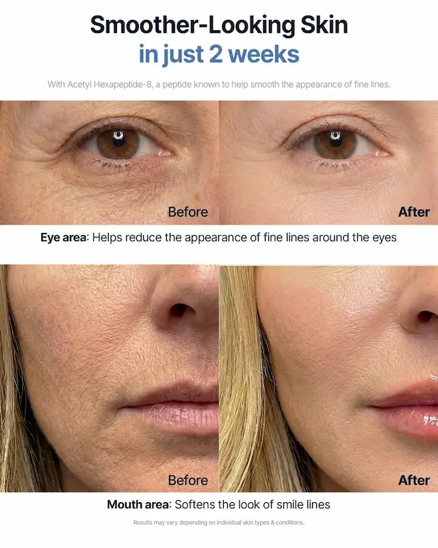 Voor-en-nafoto’s van de huid rond de ogen en mond bij SUNGBOON EDITOR Silk Peptide EGF Intensive Cream.