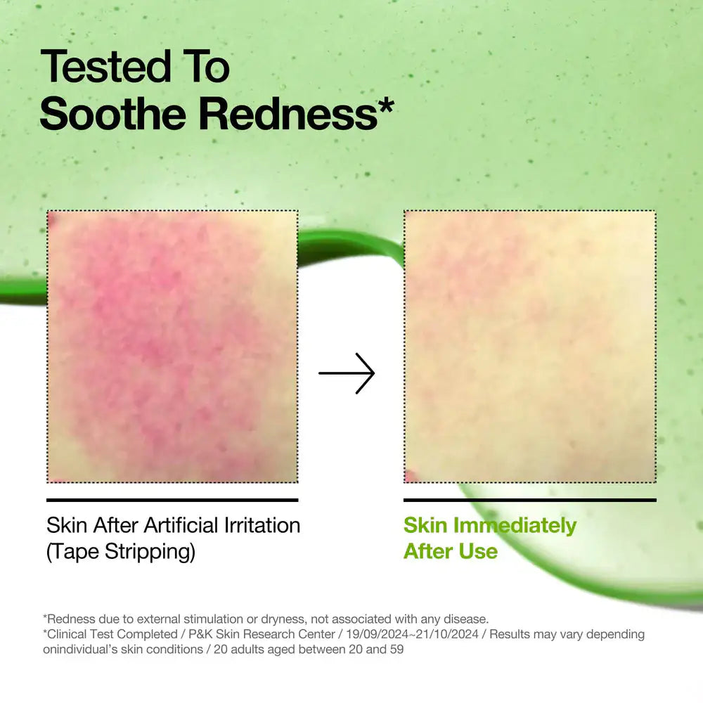 Anua Azelaic Acid 10 Hyaluron Redness Soothing Serum Azelaic zuur 10+ hyaluronserum: rode huidvlekken voor en na gebruik