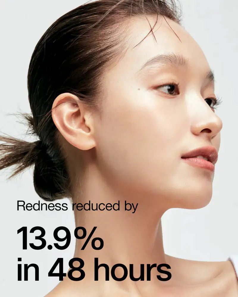Anua Anua Heartleaf 77% Soothing Toner Vrouwengezicht met kalme huid, roodheid minder opvallend