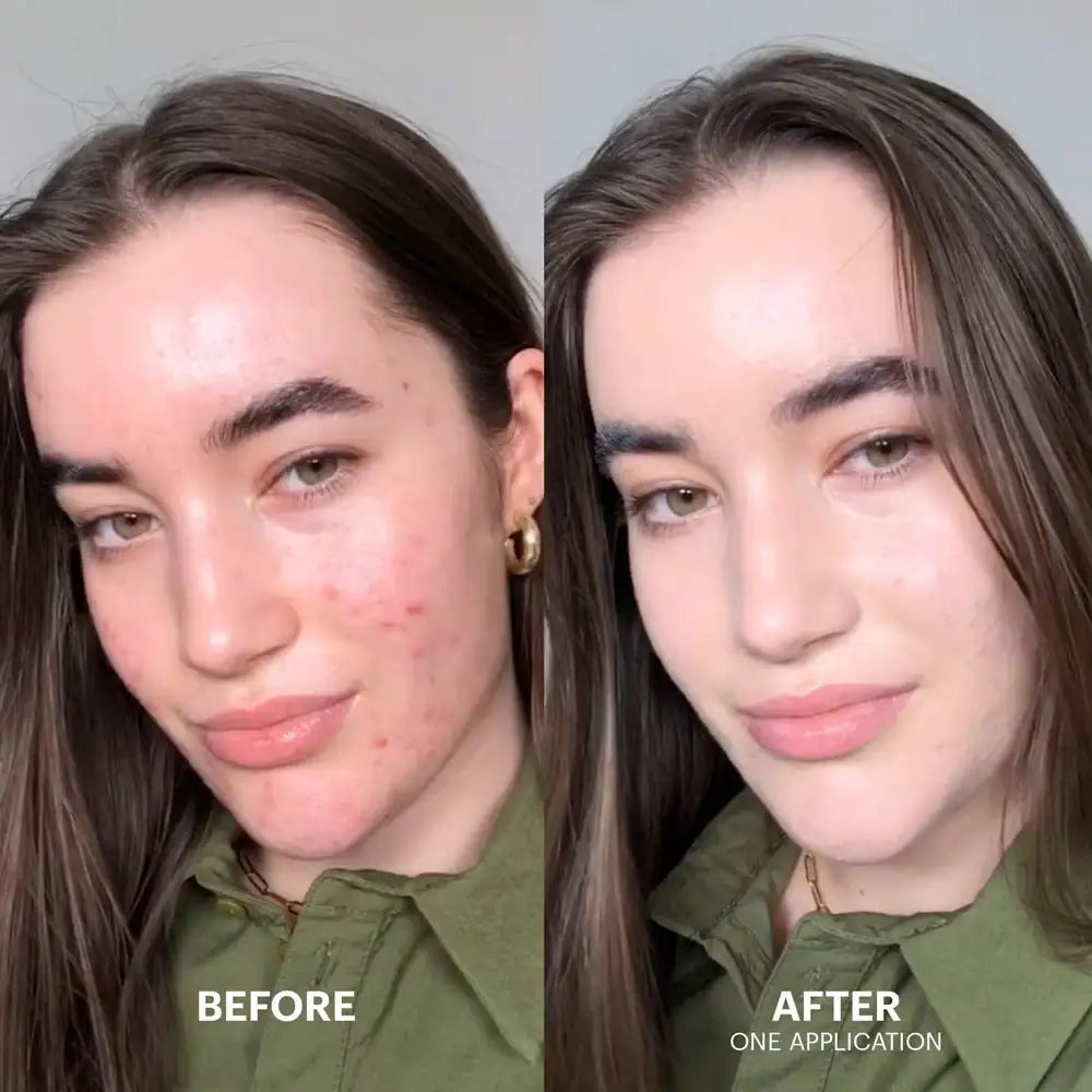 Dr. Jart+ Cicapair Tiger grass color correcting treatment Gezichtsresultaat voor en na: teint lijkt egaler na één behandeling