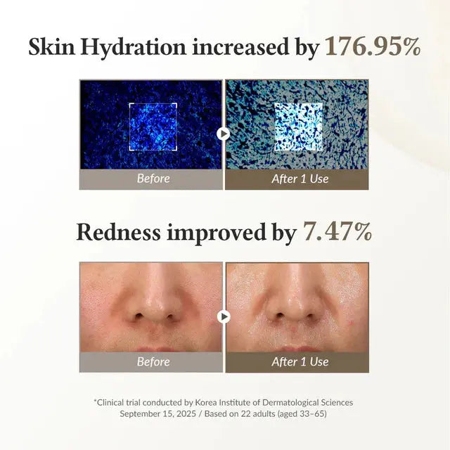 Dr. Althea 345 Relief Cream Mask voor en na resultaten