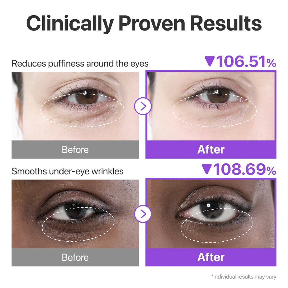 No.9 NAD Collagen Under Eye Patches